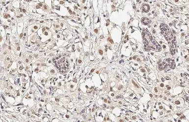 Anti-NUF2 antibody [GT312] used in IHC (Paraffin sections) (IHC-P). GTX632247