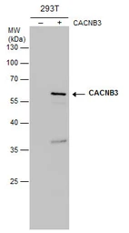 Anti-CACNB3 antibody [7D1] used in Western Blot (WB). GTX632268