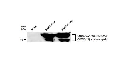Non-infected (–) and infected (+, 48h pl MOI 0.01) Caco2 whole cell extracts were separated by SDS-PAGE, and the membrane was blotted with SARS-CoV / SARS-CoV-2 (COVID-19) nucleocapsid antibody [6H3] (GTX632269) diluted at 1:1000.