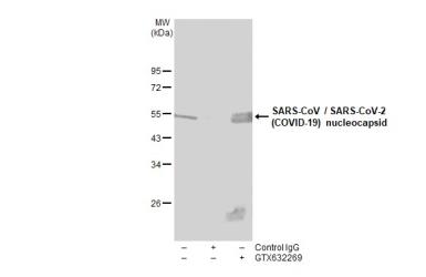 Immunoprecipitation of SARS-CoV-2 NP transfected 293T whole cell extracts using 2 μg of SARS-CoV / SARS-CoV-2 (COVID-19) nucleocapsid antibody [6H3] (GTX632269). Western blot analysis was performed using SARS-CoV / SARS-CoV-2 (COVID-19) nucleocapsid antibody [6H3] (GTX632269). EasyBlot HRP-conjugated anti mouse IgG antibody (GTX221667-01) was used to detect the primary antibody.