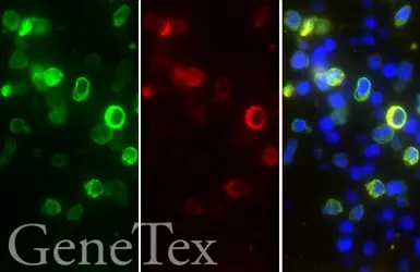 Anti-SARS-CoV / SARS-CoV-2 (COVID-19) Nucleocapsid antibody [6H3] used in IHC-P (cell pellet) (IHC-P (cell pellet)). GTX632269