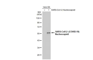 Anti-SARS-CoV / SARS-CoV-2 (COVID-19) Nucleocapsid antibody [6H3] used in Western Blot (WB). GTX632269