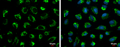 Anti-Glutaminase C (GAC) antibody [GT3211] used in Immunocytochemistry/ Immunofluorescence (ICC/IF). GTX632317