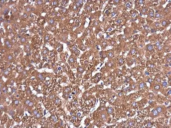 Anti-Glutaminase C (GAC) antibody [GT3211] used in IHC (Paraffin sections) (IHC-P). GTX632317