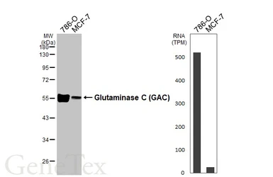 Anti-Glutaminase C (GAC) antibody [GT3211] used in Western Blot (WB). GTX632317