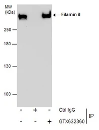 Anti-Filamin B antibody [GT1372] used in Immunoprecipitation (IP). GTX632360