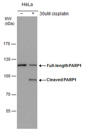 Anti-PARP antibody [GT982] used in Western Blot (WB). GTX632388