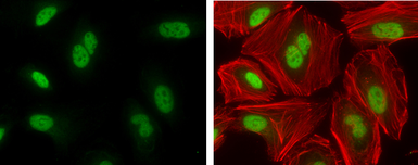Anti-PARP antibody [GT982] used in Immunocytochemistry/ Immunofluorescence (ICC/IF). GTX632388