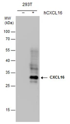 Anti-CXCL16 antibody [GT5212] used in Western Blot (WB). GTX632390