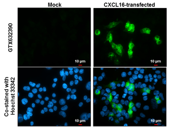 Anti-CXCL16 antibody [GT5212] used in Immunocytochemistry/ Immunofluorescence (ICC/IF). GTX632390