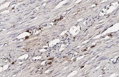 Anti-CXCL16 antibody [GT5212] used in IHC (Paraffin sections) (IHC-P). GTX632390