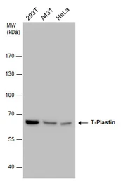Anti-T-Plastin antibody [GT3310] used in Western Blot (WB). GTX632482
