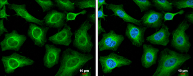 Anti-T-Plastin antibody [GT3310] used in Immunocytochemistry/ Immunofluorescence (ICC/IF). GTX632482
