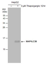 Anti-LC3B antibody [GT3612] used in Western Blot (WB). GTX632501