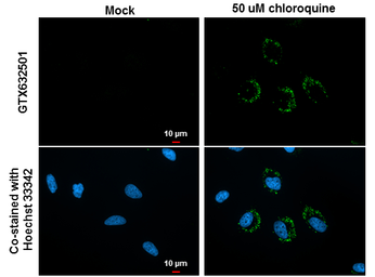 Anti-LC3B antibody [GT3612] used in Immunocytochemistry/ Immunofluorescence (ICC/IF). GTX632501