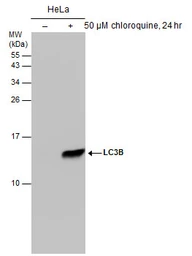 Anti-LC3B antibody [GT3612] used in Western Blot (WB). GTX632501