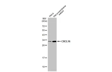 Anti-CXCL16 antibody [GT516] used in Western Blot (WB). GTX632502