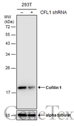 Anti-Cofilin 1 antibody [GT217] used in Western Blot (WB). GTX632582