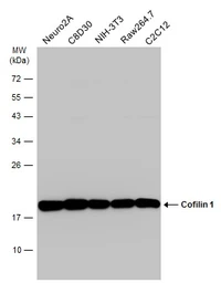 Anti-Cofilin 1 antibody [GT217] used in Western Blot (WB). GTX632582