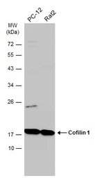 Anti-Cofilin 1 antibody [GT217] used in Western Blot (WB). GTX632582