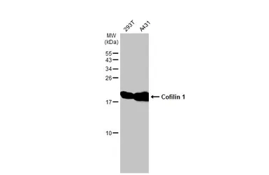 Anti-Cofilin 1 antibody [GT217] used in Western Blot (WB). GTX632582