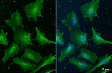 Anti-Cofilin 1 antibody [GT217] used in Immunocytochemistry/ Immunofluorescence (ICC/IF). GTX632582
