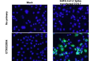 SARS-CoV / SARS-CoV-2 (COVID-19) spike antibody [1A9] detects SARS-CoV-2 (COVID-19) spike protein by immunofluorescent analysis. Sample: Mock and SARS-CoV-2-transfected COS-7 cells were fixed in 4% paraformaldehyde for 10 min at room temperature. Green: SARS-CoV-2 (COVID-19) spike stained by SARS-CoV / SARS-CoV-2 (COVID-19) spike antibody [1A9] (GTX632604). Blue: Nuclei were counterstained with DAPI. *From Zheng Z, et al. bioRxiv(2020). Shown under license agreement