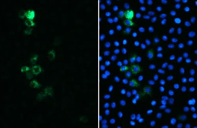 Anti-SARS-CoV / SARS-CoV-2 (COVID-19) spike antibody [1A9] used in Immunocytochemistry/ Immunofluorescence (ICC/IF). GTX632604