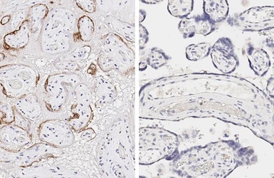 Anti-SARS-CoV / SARS-CoV-2 (COVID-19) spike antibody [1A9] used in IHC (Paraffin sections) (IHC-P). GTX632604