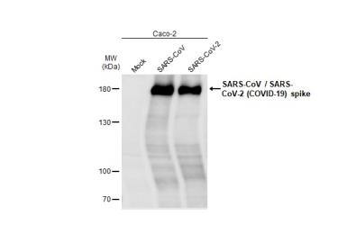 Non-infected (–) and infected (+, 48h pl MOI 0.01) Caco-2 whole cell extracts were separated by SDS-PAGE, and the membrane was blotted with SARS-CoV / SARS-CoV-2 (COVID-19) spike antibody [1A9] (GTX632604) diluted at 1:1000.