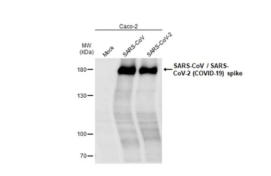 Anti-SARS-CoV / SARS-CoV-2 (COVID-19) spike antibody [1A9] used in Western Blot (WB). GTX632604