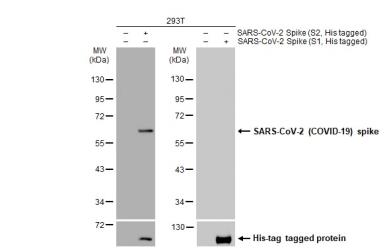 Non-transfected (–) and transfected (+) 293T whole cell extracts (30 μg) were separated by 10% SDS-PAGE, and the membrane was blotted with SARS-CoV / SARS-CoV-2 (COVID-19) spike antibody [1A9] (GTX632604) diluted at 1:5000. The HRP-conjugated anti-mouse IgG antibody (GTX213111-01) was used to detect the primary antibody.
