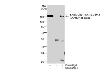 Immunoprecipitation of SARS-CoV-2 Spike transfected 293T whole cell extracts using 2 μg of SARS-CoV / SARS-CoV-2 (COVID-19) spike antibody [1A9] (GTX632604). Western blot analysis was performed using SARS-CoV / SARS-CoV-2 (COVID-19) spike antibody [1A9] (GTX632604). EasyBlot HRP-conjugated anti mouse IgG antibody (GTX221667-01) was used to detect the primary antibody.
