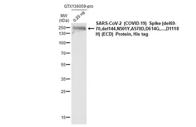 Anti-SARS-CoV / SARS-CoV-2 (COVID-19) spike antibody [1A9] used in Western Blot (WB). GTX632604