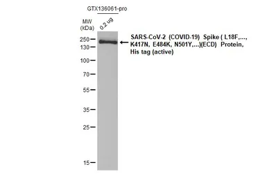 Anti-SARS-CoV / SARS-CoV-2 (COVID-19) spike antibody [1A9] used in Western Blot (WB). GTX632604