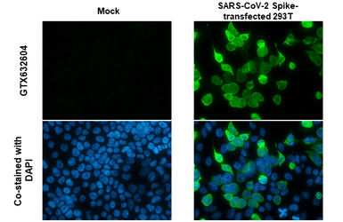 Anti-SARS-CoV / SARS-CoV-2 (COVID-19) spike antibody [1A9] used in Immunocytochemistry/ Immunofluorescence (ICC/IF). GTX632604