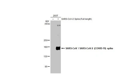 Anti-SARS-CoV / SARS-CoV-2 (COVID-19) spike antibody [1A9] used in Western Blot (WB). GTX632604
