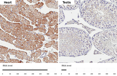 Anti-SDHA antibody [GT20710] used in IHC (Paraffin sections) (IHC-P). GTX632636