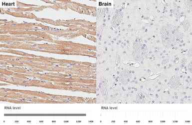 Anti-MYH6 antibody [GT5612] used in IHC (Paraffin sections) (IHC-P). GTX632649