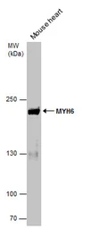 Anti-MYH6 antibody [GT565] used in Western Blot (WB). GTX632650
