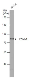 Anti-FACL4 antibody [GT566] used in Western Blot (WB). GTX632675