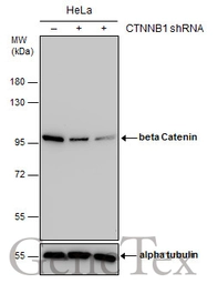 Anti-beta Catenin antibody [GT3171] used in Western Blot (WB). GTX632676