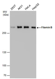 Anti-Filamin B antibody [GT1282] used in Western Blot (WB). GTX632677