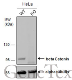 Anti-beta Catenin antibody [GT2169] used in Western Blot (WB). GTX633010
