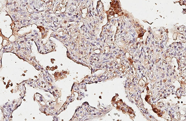 Anti-beta Catenin antibody [GT2169] used in IHC (Paraffin sections) (IHC-P). GTX633010