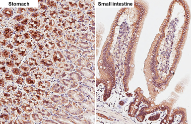 Anti-beta Catenin antibody [GT2169] used in IHC (Paraffin sections) (IHC-P). GTX633010