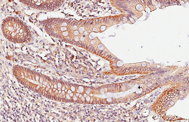 Anti-beta Catenin antibody [GT2169] used in IHC (Paraffin sections) (IHC-P). GTX633010