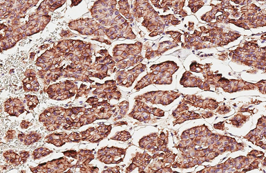 Anti-beta Catenin antibody [GT2169] used in IHC (Paraffin sections) (IHC-P). GTX633010
