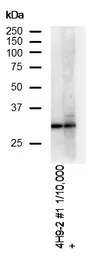 Anti-DAPP1 antibody [4H9] used in Western Blot (WB). GTX633252