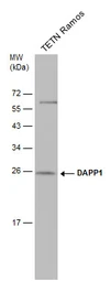 Anti-DAPP1 antibody [4H9] used in Western Blot (WB). GTX633252